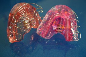 Apparecchi-Ortodonzia Dentista Giovinazzo Studio De Palma - Apparecchi di Ortodonzia