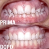 ortodonzia-03